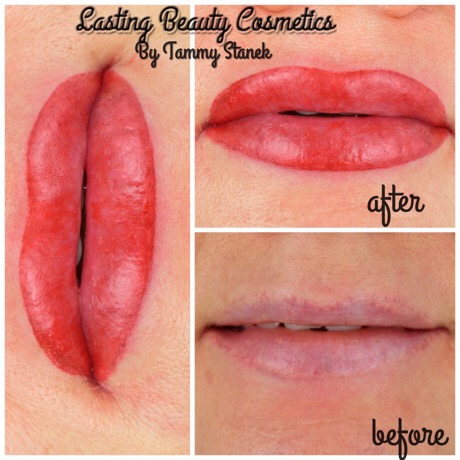 Permanent makeup lips Madison by Lasting Beauty Cosmetics